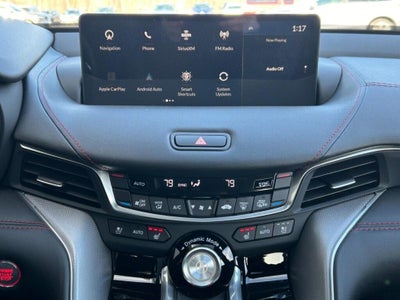 2025 Acura TLX A-Spec Package SH-AWD