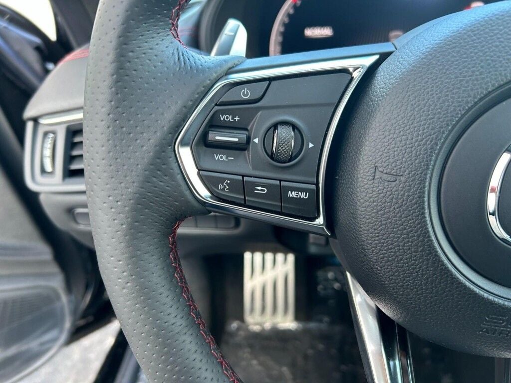 2025 Acura TLX A-Spec Package SH-AWD